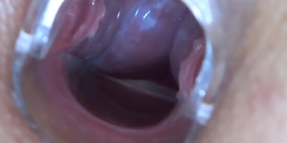 speculum babe anally fingered and toyed in erotic couple