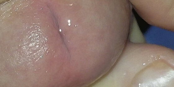 close cum