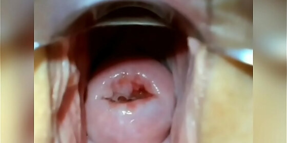 see how she opens her whole vagina