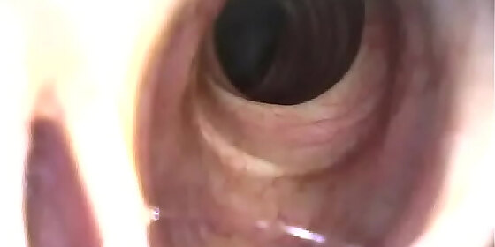 paige trachea revealed