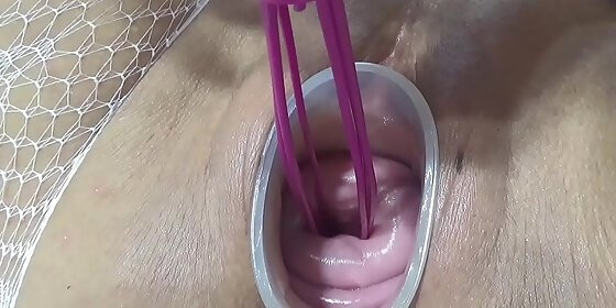 mature wife fucking cervix and penetration in uterus with knifes