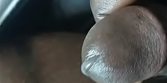 sperm