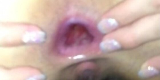 gaping anal after huge cock from step bro