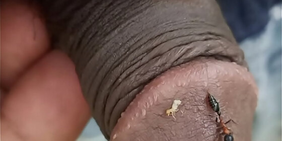 ant bite my penice