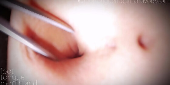 belly button exam part 2