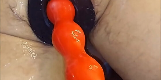 everted anus