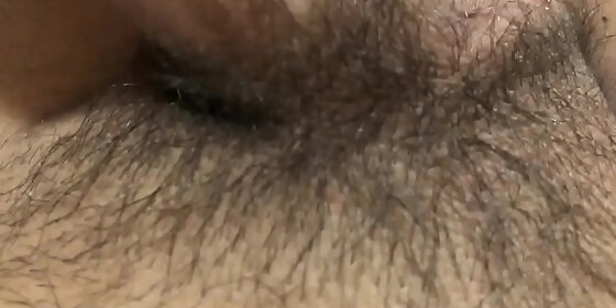 i have a hairy penis again