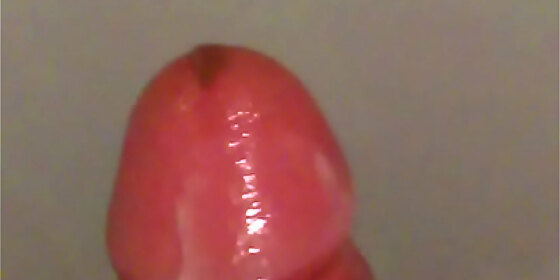 the head of my penis
