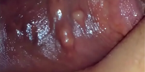 anal