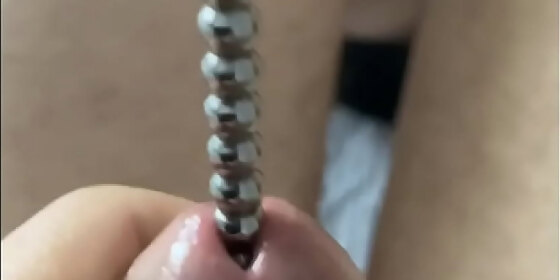 metal dilator in peehole 3