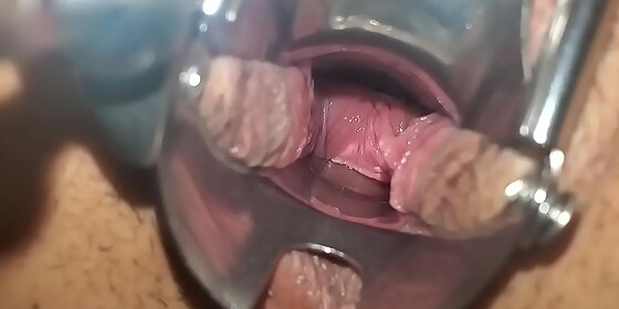 speculum in pussy close up