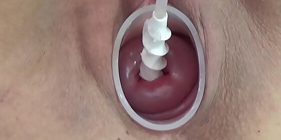 milf cervix insertion with spiral catheter for insemination and vibrator jav extreme