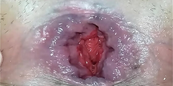 after shower gaping