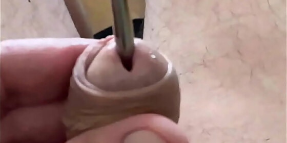 metal dilator in my peehole 5