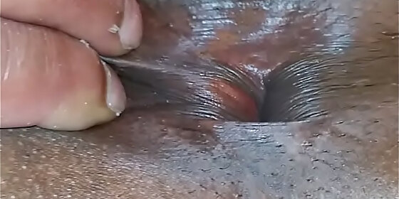 my hole